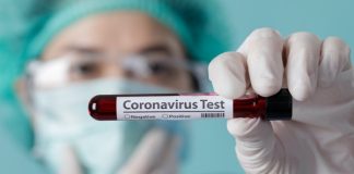 58 Reaktif Covid19 dari 1010 Orang di Lotim