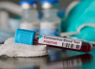 Gubernur NTB : Pasien Positif Covid 19 Bertambah Jadi 4 Orang