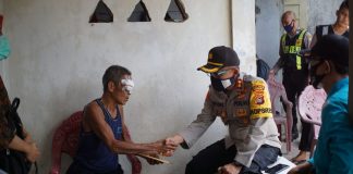 Ini Alasan Kapolres Sumbawa Rujuk Penderita Tumor Mata Berobat Ke Mataram