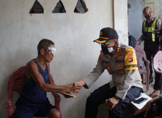 Ini Alasan Kapolres Sumbawa Rujuk Penderita Tumor Mata Berobat Ke Mataram