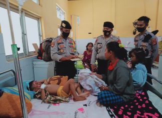 Jama’ah masjid Polres Dompu Santuni Bocah Luka bakar