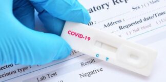 Seleksi KPID NTB: Peserta Pertanyakan Test Swab Antigen dan Status Petahana Dapat Perlakuan Khusus