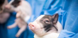 Fatwa Al-Azhar Mesir Izinkan Transplantasi Ginjal Babi ke Manusia