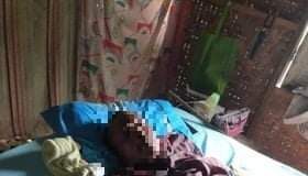 15 Tahun Lumpuh, Warga Utan Sumbawa ini Terima Bantuan Pemerintah