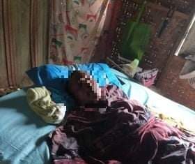 15 Tahun Lumpuh, Warga Utan Sumbawa ini Terima Bantuan Pemerintah