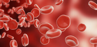 Mengenal Purpura Trombositopenia Imun