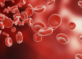 Mengenal Purpura Trombositopenia Imun