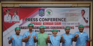 RSU Propinsi NTB Berhasil Operasi Kembar Siam